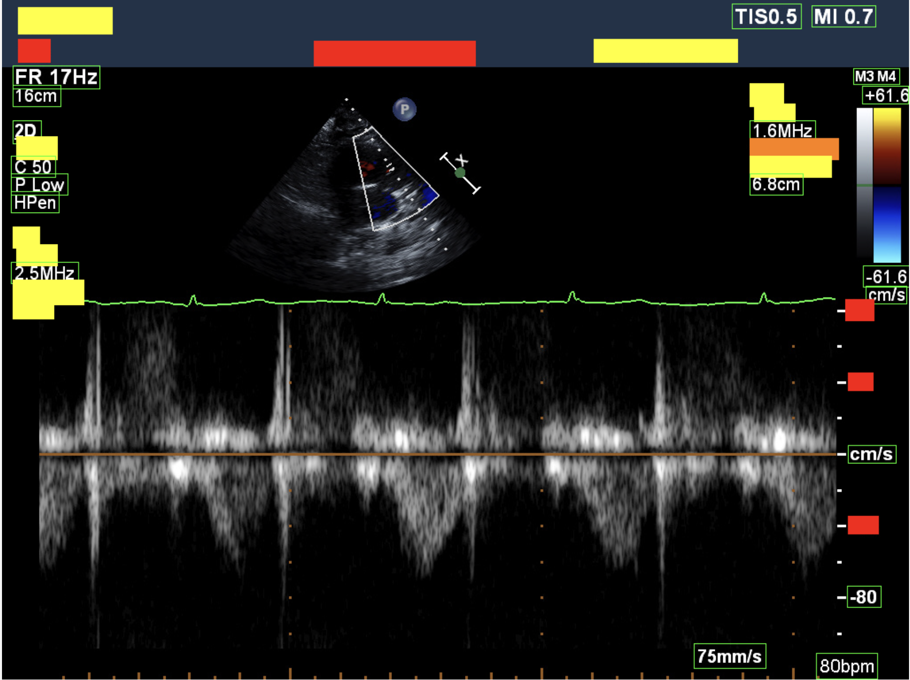 Deidentified DICOM example 1