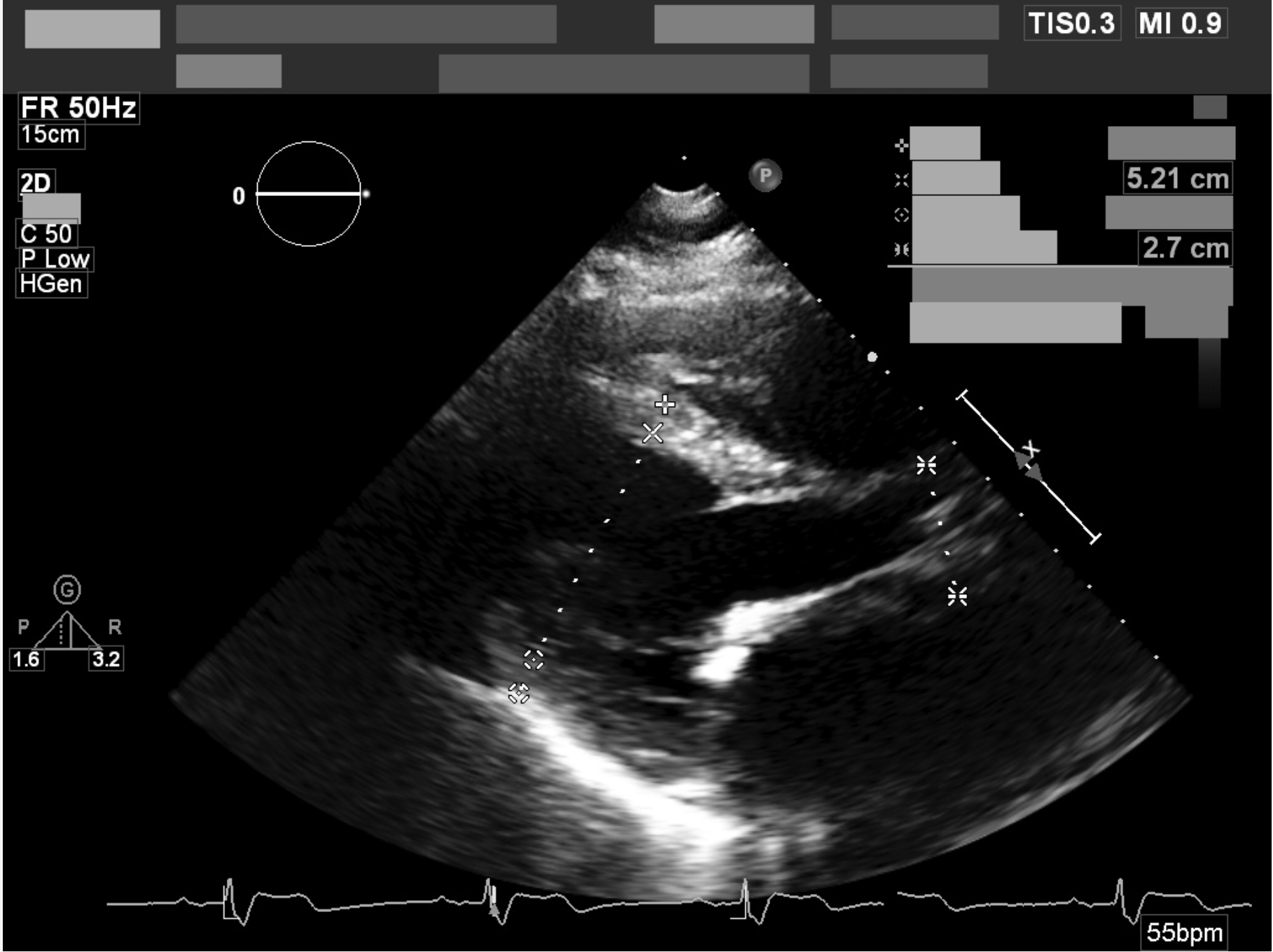 Deidentified DICOM example 2